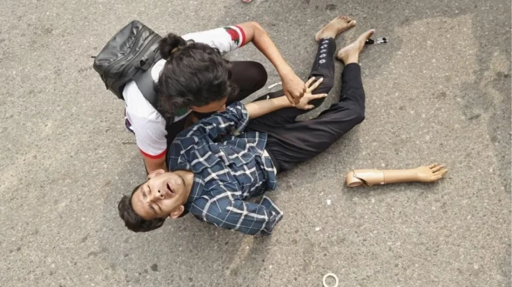 পুলিশের সঙ্গে সংঘর্ষে রাস্তায় পড়ে ছিল কৃত্রিম হাত: ঢামেকে চিকিৎসা নিচ্ছেন ১০ জুলাই যোদ্ধা