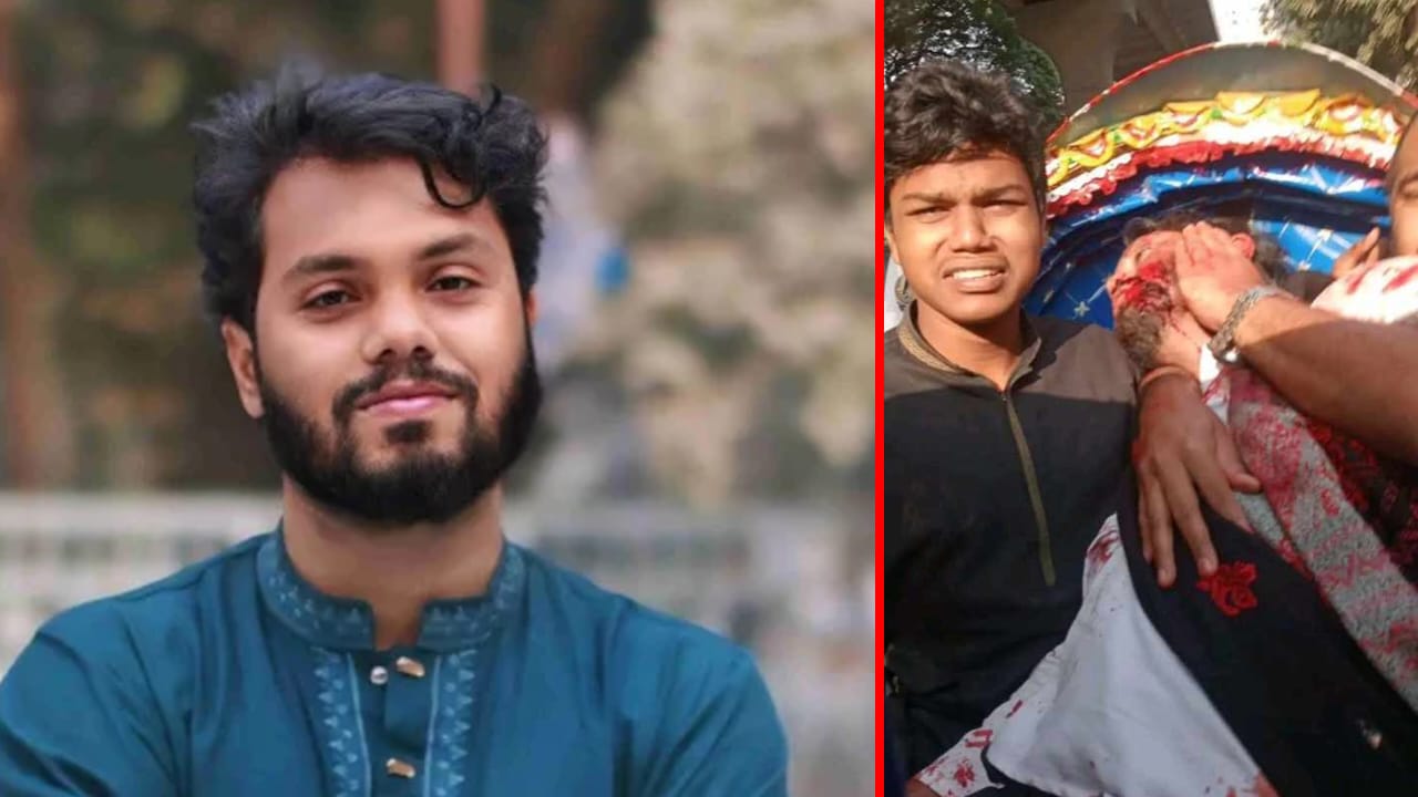 ওসমান হাদির অবস্থা গুরুতর, এখন কোমায় আছেন : চিকিৎসক