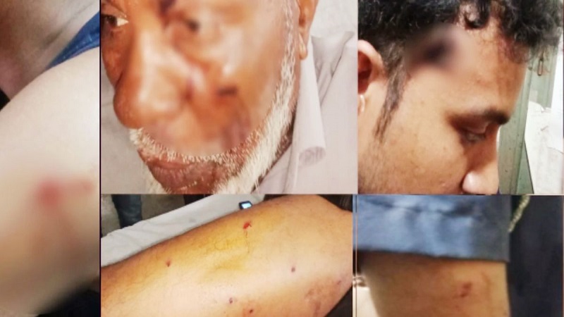 সন্ত্রাসীদের হামলায় ওসিসহ ৫ পুলিশ সদস্য গুলিবিদ্ধ