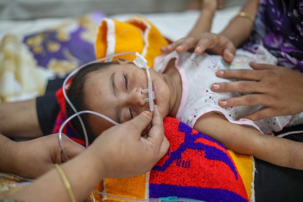হামের উপসর্গে আরও ১৬ শিশুর মৃত্যু, মোট প্রাণহানি ৫২৮