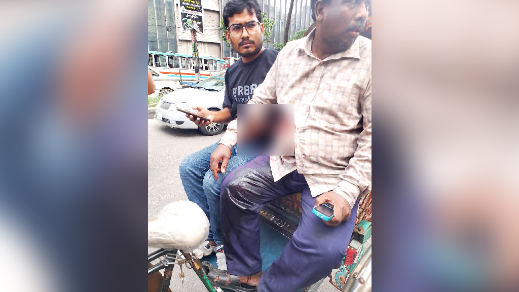মতিঝিলে প্রকাশ্যে গুলি করে ছিনতাই: ব্যাগে ৬০ লাখ টাকা ছিল বলে দাবি